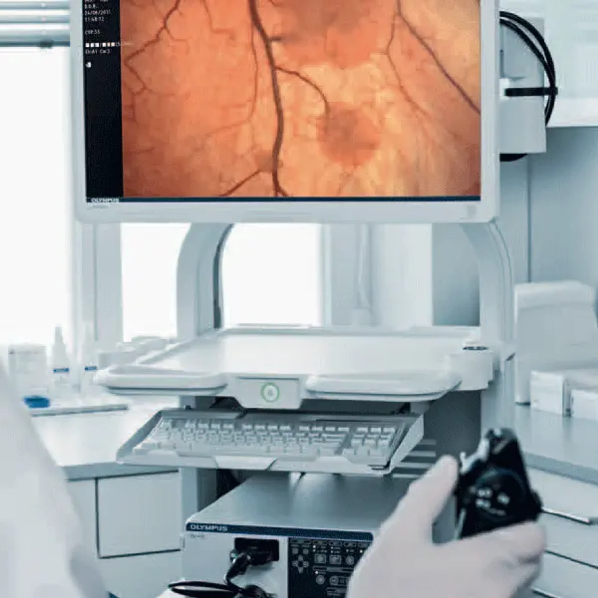 Blasenspiegelung und Endoskopie im UROMED KompetenzZentrum Urologie in 1150 Wien