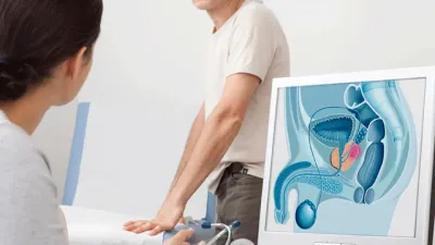 Prostatakrebs - Urologe in Wien